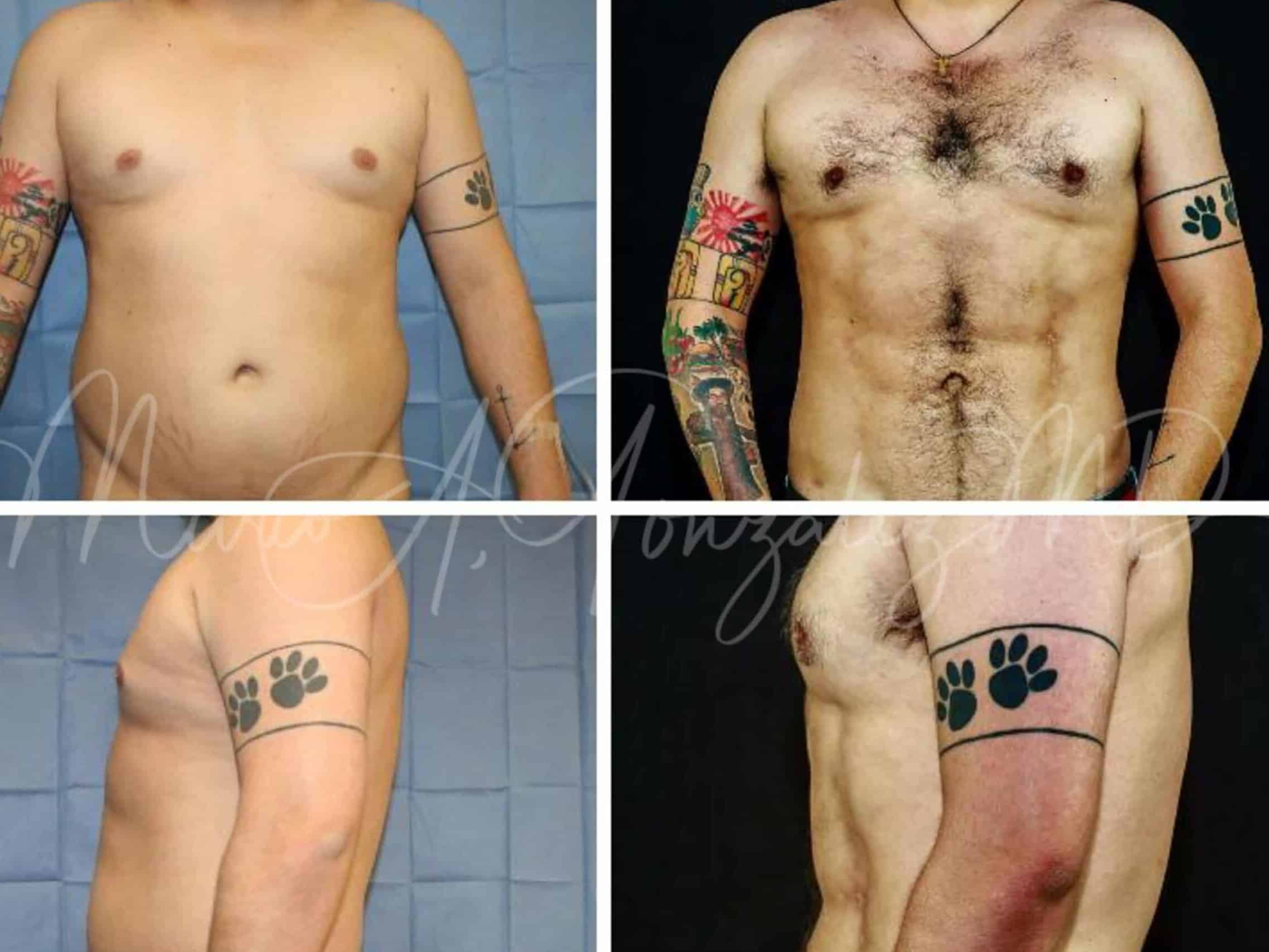 Case--2316 | Before Body