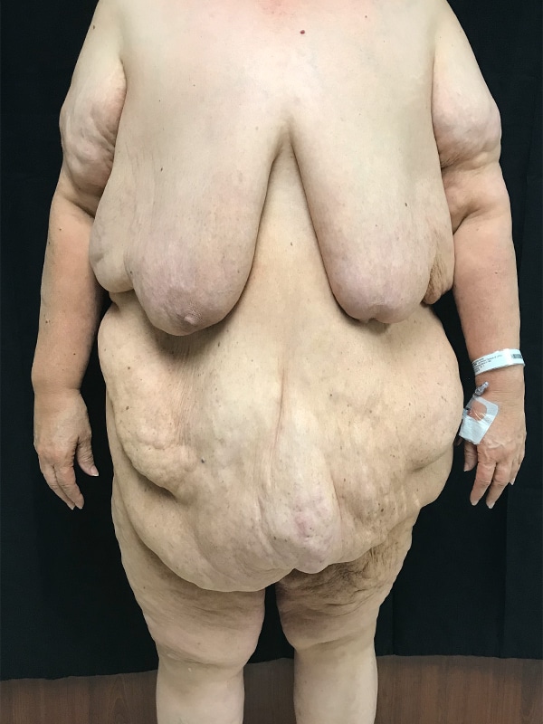 Case--6290 | Before Body