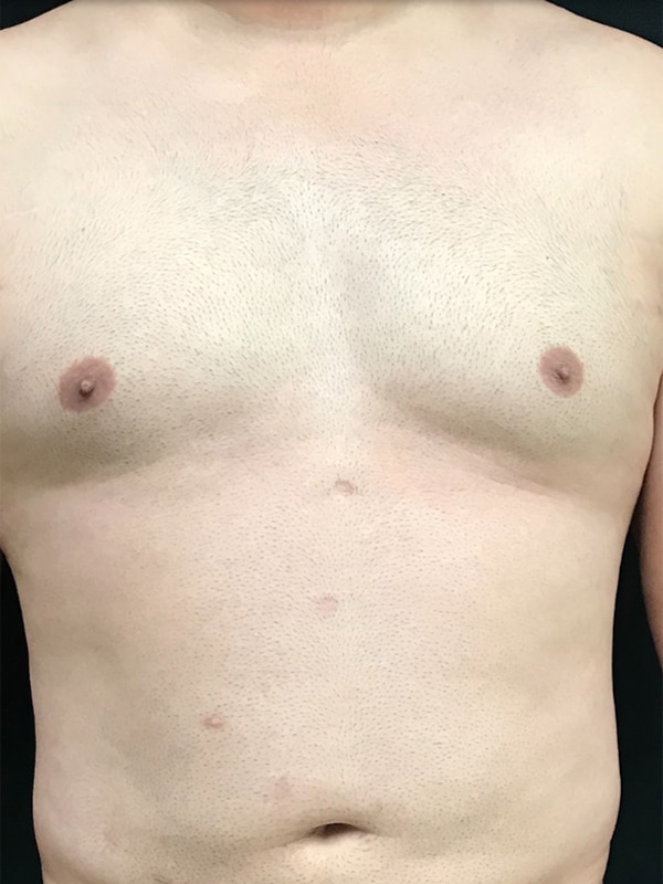 Case--1027 | Before Body