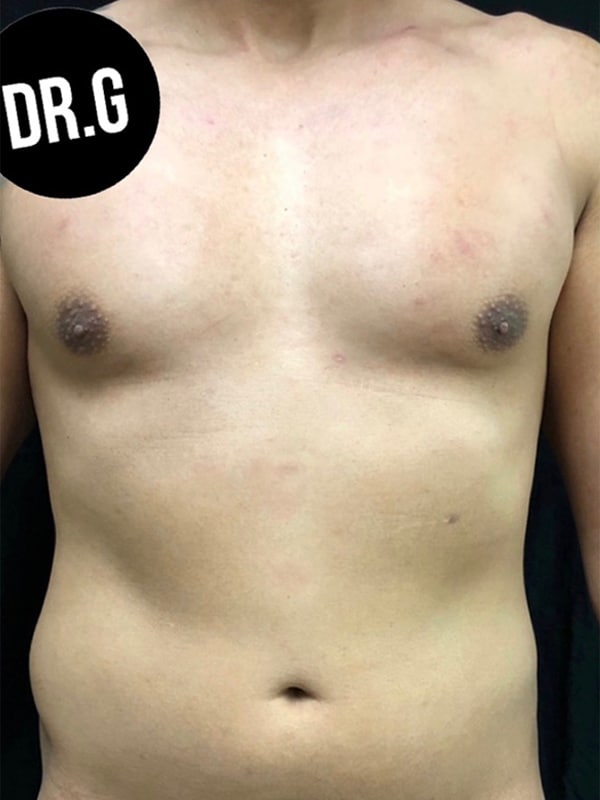 Case--1675 | Before Body